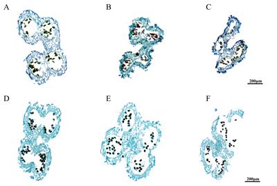 Transcriptome and genome-wide analysis of the potential role of SKP1 gene family in the development of floral organs of two related species of Allium fistulosum